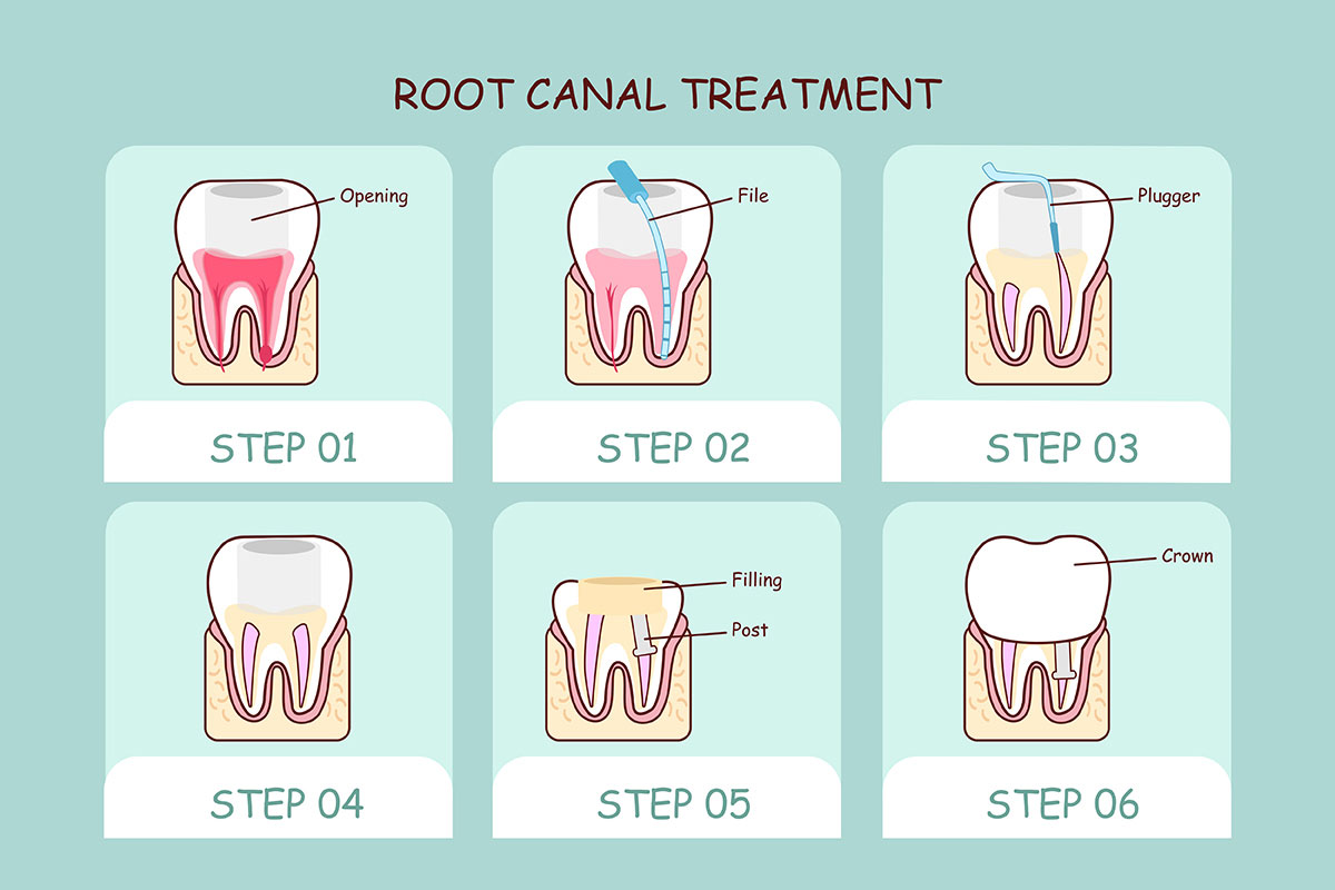 Dentist at Aransas Pass TX