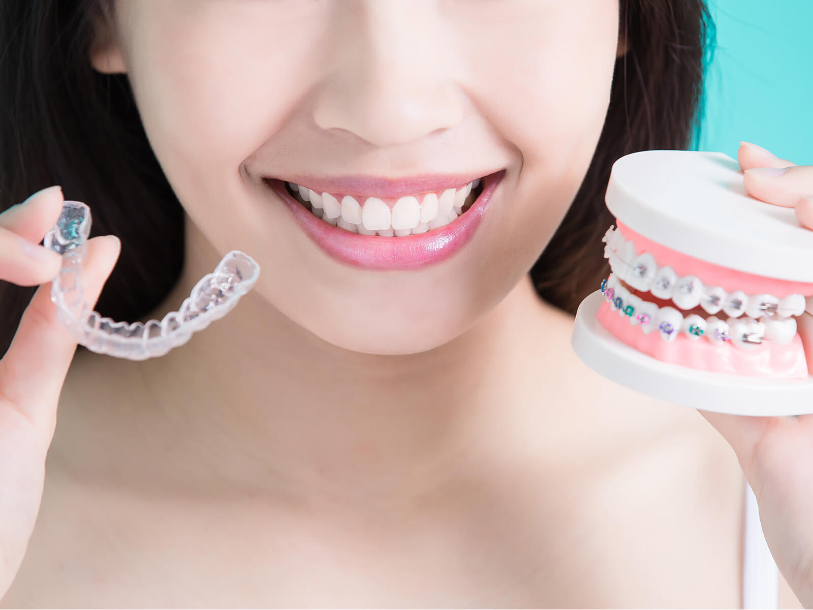 Exploring The Latest Trends In Orthodontics: Braces Vs. Invisalign