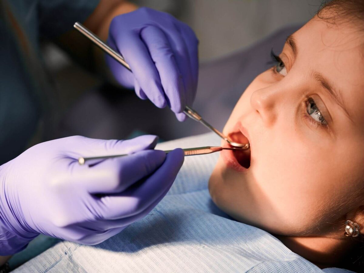 How To Care For Teeth After Getting Dental Sealants